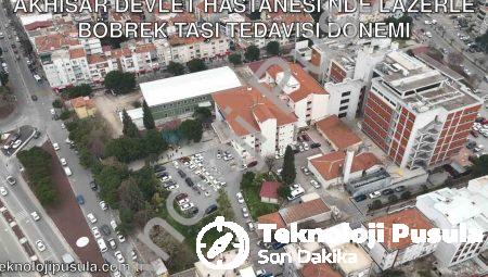 Akhisar Devlet Hastanesi’nde Lazerle Böbrek Taşı Tedavisi Dönemi